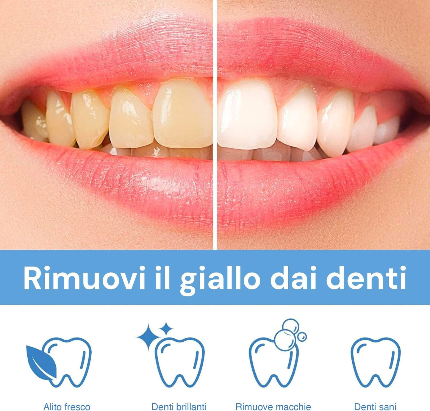 Pearlsher InnovaGoods Sbiancamento e lucidatura dei denti