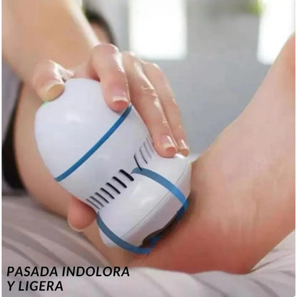 Callus remover